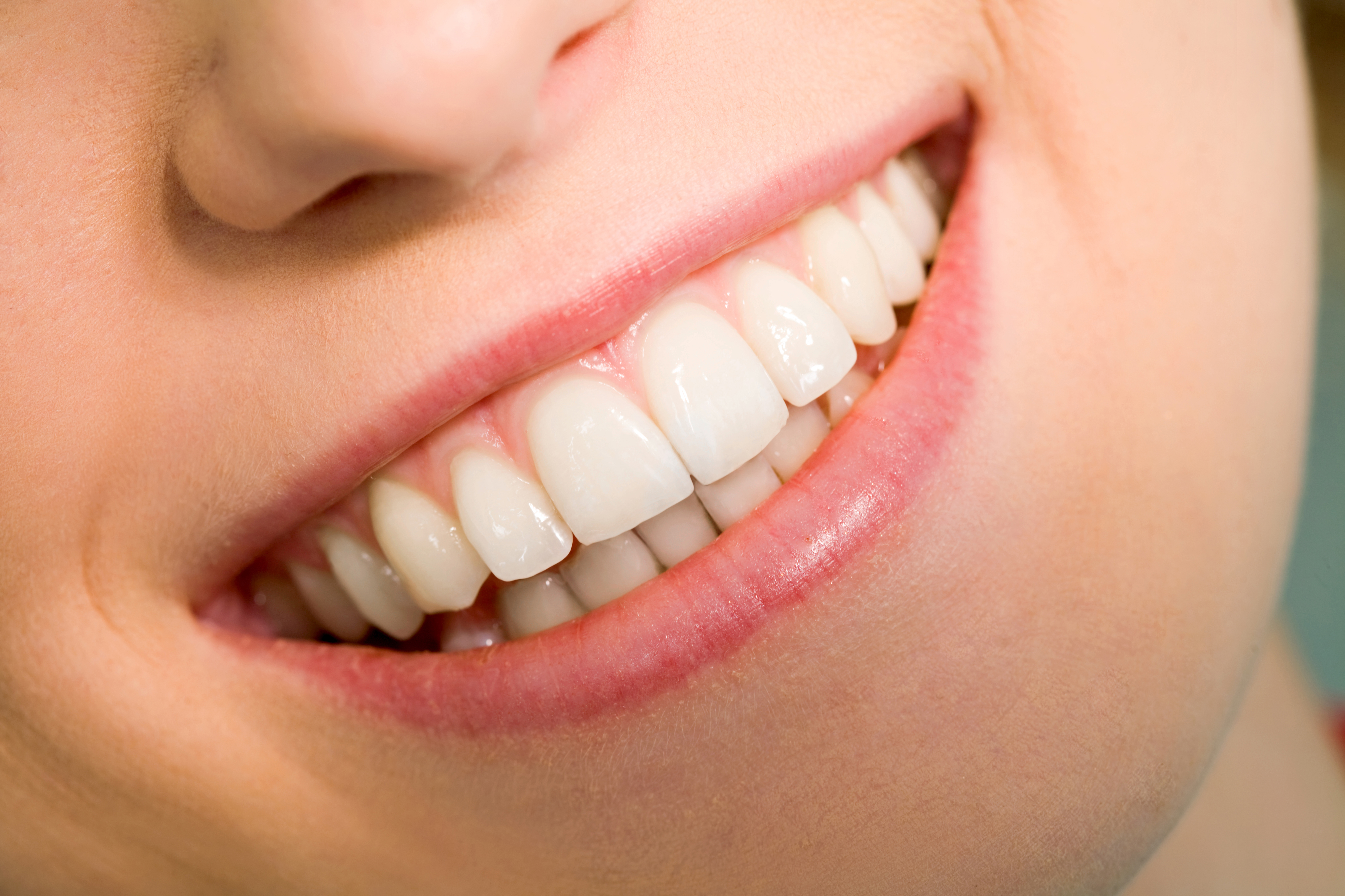 Three Good Reasons Why You Should Trust Your Teeth Whitening Procedure to A Dentist in Spring