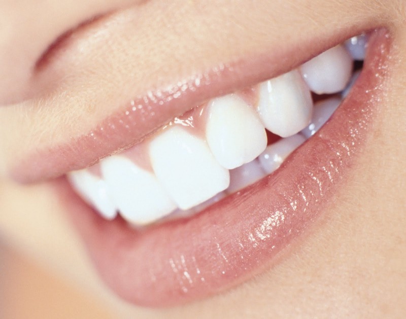 Improve the Appearance of That Smile With Beautiful Porcelain Veneers in Indianapolis IN