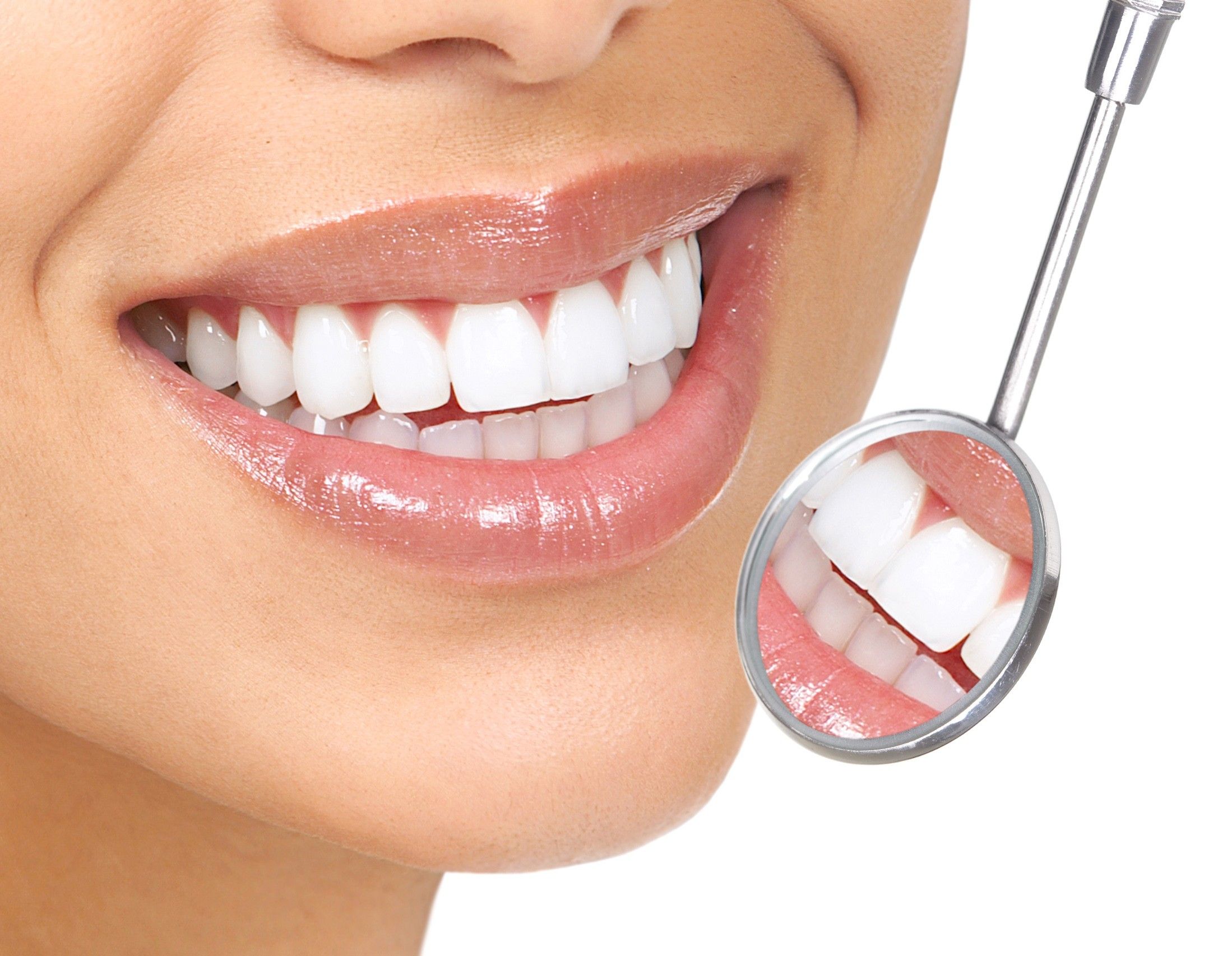 Talk to Your Dentist About Teeth Whitening in Clifton
