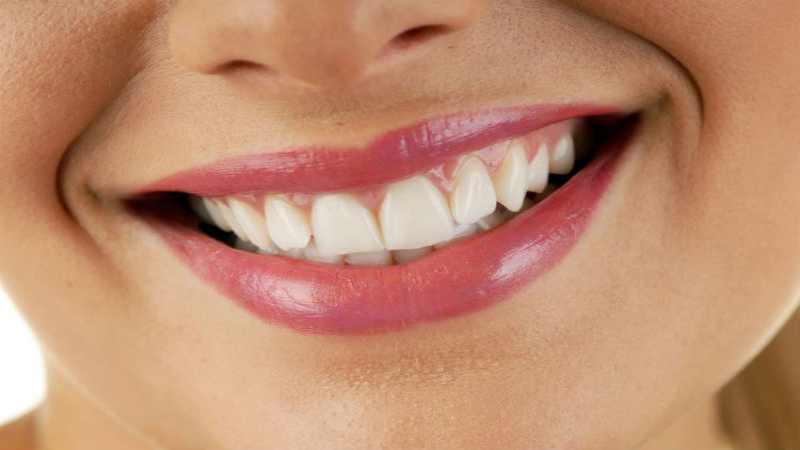 Teeth Whitening in Chicago for a Dazzling Smile