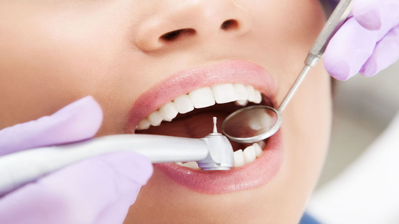 The Things You Can Get Done by a Cosmetic Dentist in Salem, OR