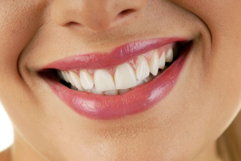 Get Advice about Wearing Invisalign in Grand Island, NE to Correct Teeth